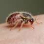 What to Do About Scabies, Lice & Treatment Options