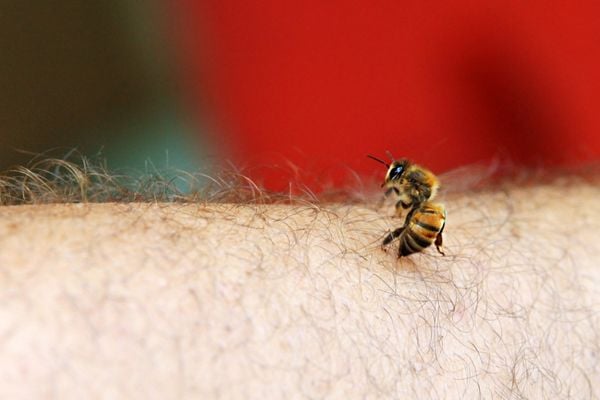 Bee stinging arm